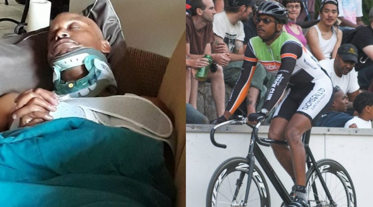 David Magloire Before and After