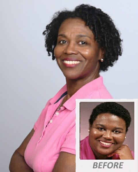 Kimberly-Taylor-Halfshot_with-Before